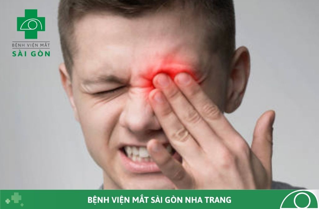 ĐỎ MẮT: CÁC NGUYÊN NHÂN VÀ NGUY CƠ GÂY GIẢM THỊ LỰC